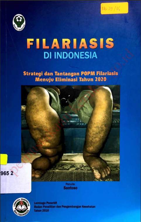 Cover FILARIASIS DI INDONESIA :  Strategi Dan Tantangan POPM Filariasis Menuju Eliminasi Tahun 2020 / Santoso