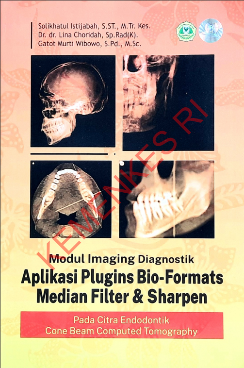 Cover Modul Imaging Diagnostik Aplikasi Plugins Bio-Formats Median Filter _ Sharpen :  Pada Citra Endodontik Cone Beam Computed Tomography / Politeknik Kesehatan Kementerian Kesehatan Semarang