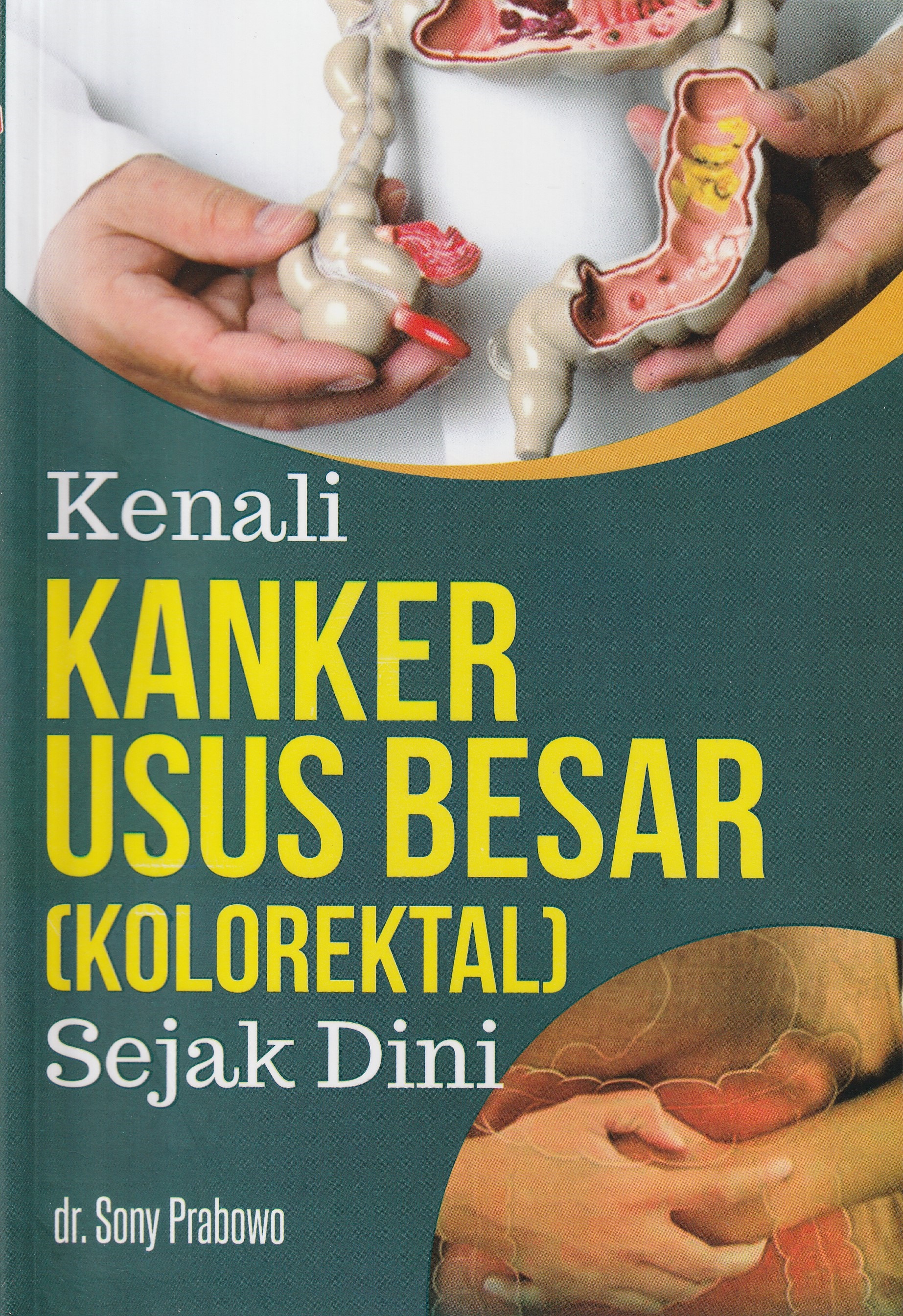 Cover Kenali Kanker Usus Besar (Kolorektal) :  Sejak Dini / dr. Sony Prabowo