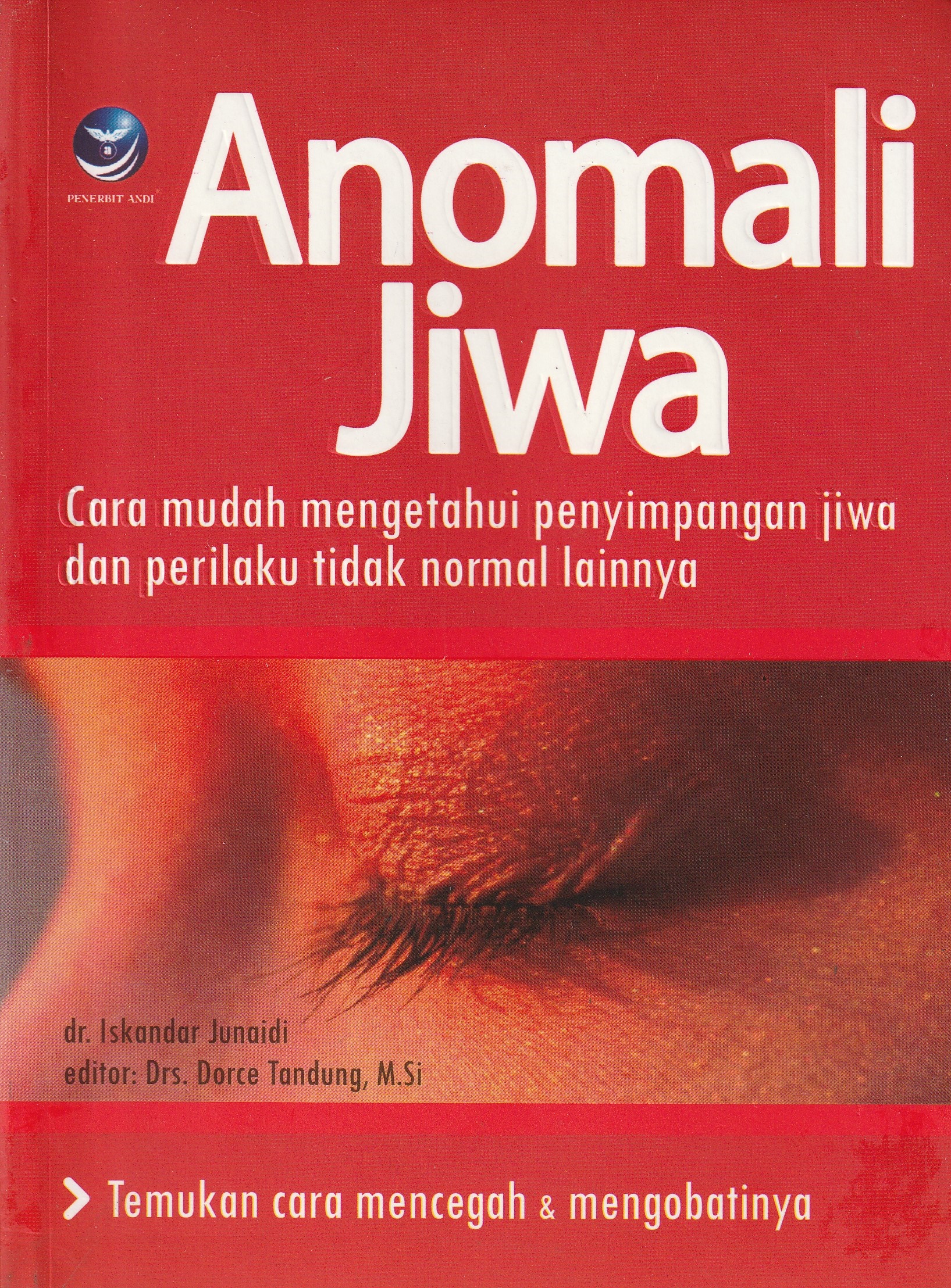 Cover Anomali Jiwa :  Cara Mudah Mengetahui Penyimpangan jiwa dan Perilaku Tidak Normal Lainnya / dr. Iskandar Junaidi