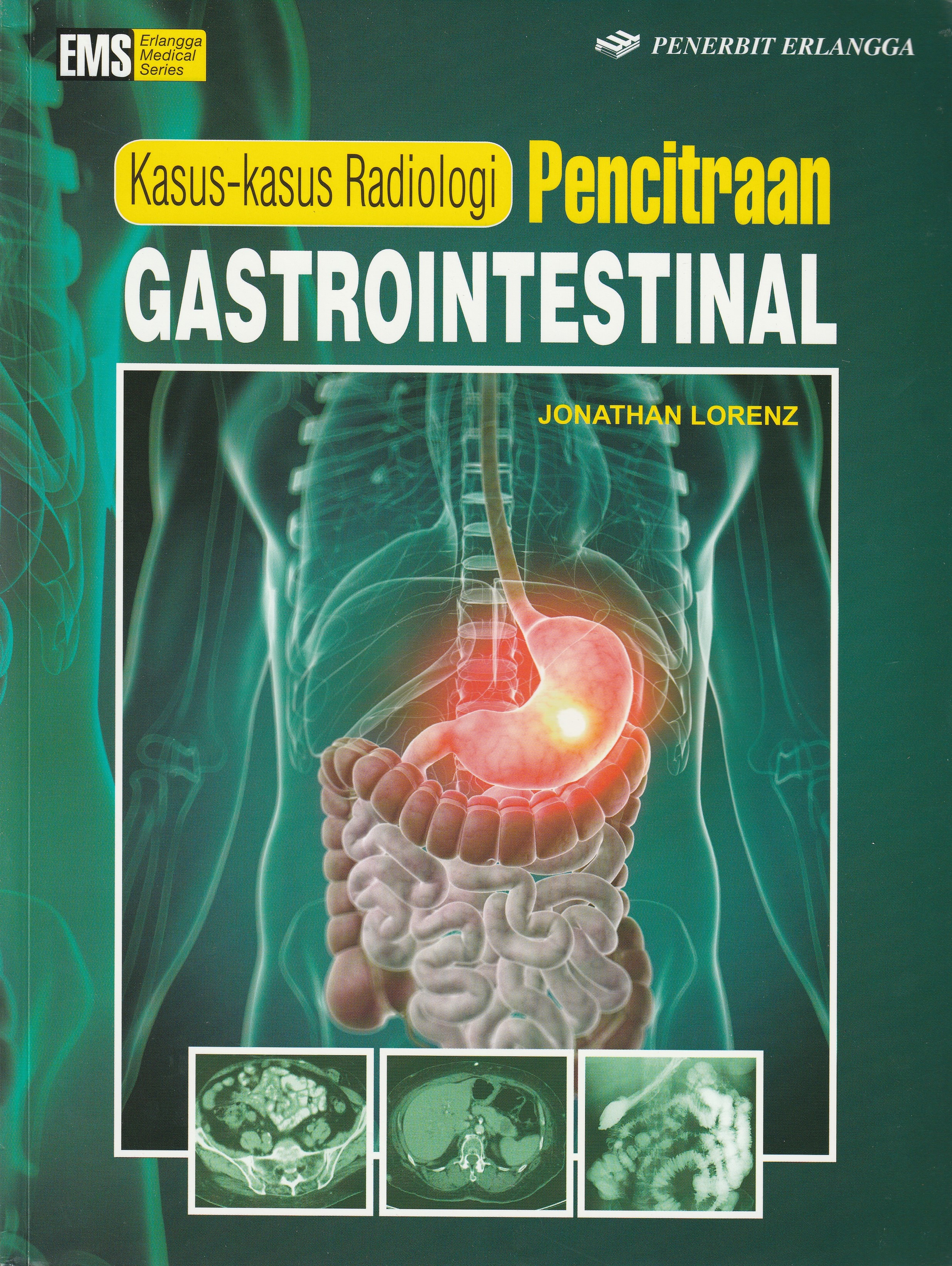 Cover Kasus-kasus Radiologi Pencitraan Gastrointestinal :  - / Jonathan Lorenz
