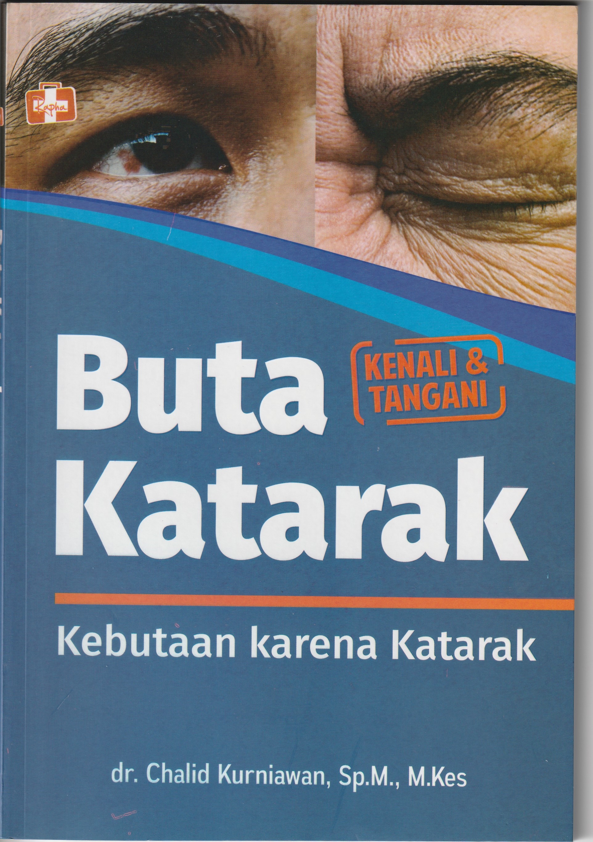 Cover Buta Katarak. :  Kebutaan karena Katarak / dr. Chalid Kurniawan, Sp.M, M.Kes
